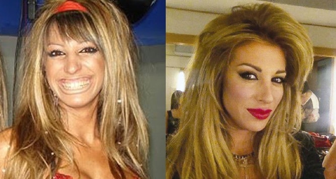 Stefy Xipolitakis antes y después de las cirugías famosas argentinas