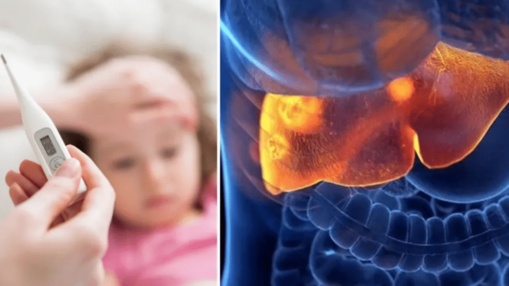 Hepatitis infantil aguda