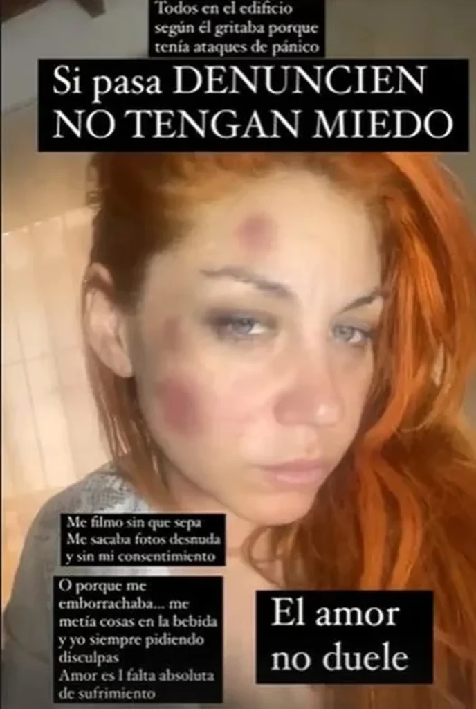 Post de Lowrdez de Bandana coincide con denuncia de desaparición